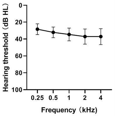 Relationship Between the Ability to Detect Frequency Changes or Temporal Gaps and Speech Perception Performance in Post-lingual Cochlear Implant Users